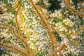 Trichomes (Digital Download)